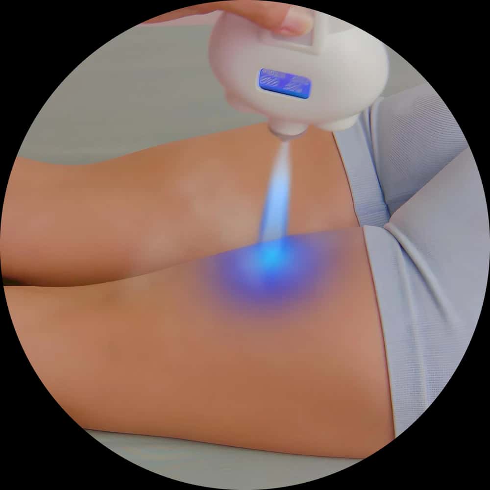 Localized Cryotherapy