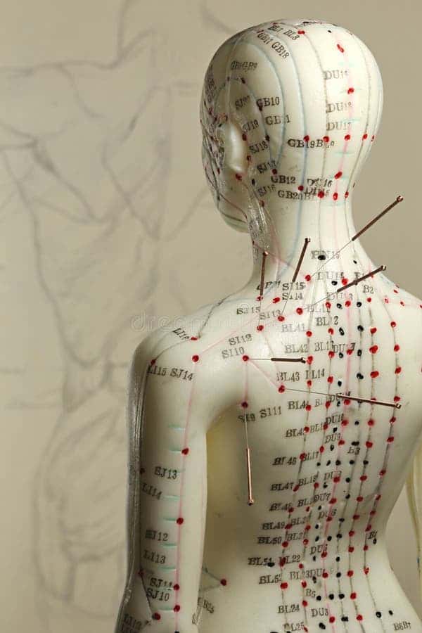 Mini Acupuncture treatment